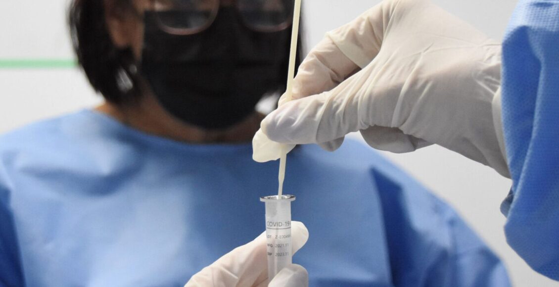 Fiocruz aponta sinais de queda em alta recente da covid-19 no país
