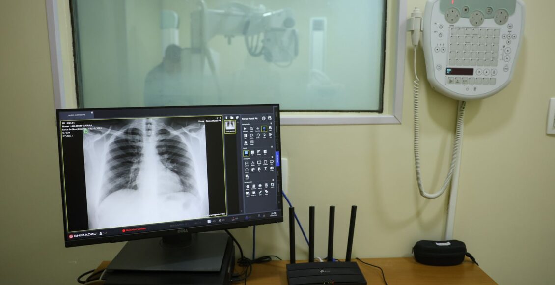 Brasil tem aumento de hospitalizações por Influenza A, alerta Fiocruz
